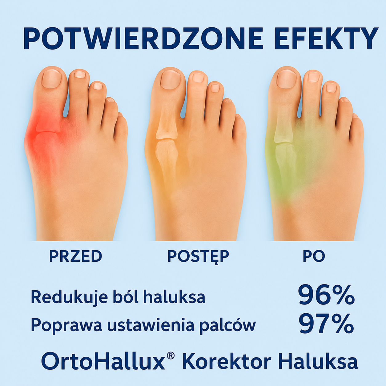 OrtoHallux™ Koniec z haluksami